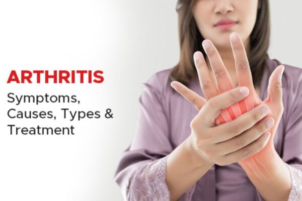 what is attrities? Symptoms, Causes, Types & Treatment Guide what is attrities? Symptoms, Causes, Types & Treatment Guide